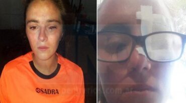 Florencia Botto sufrió una dura agresión en un partido de fútbol femenino en Paraná. Gentileza: Diario UNO