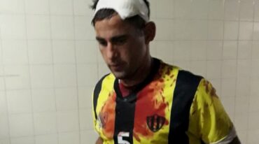 Batista tuvo que ser trasladado a un centro asistencial.