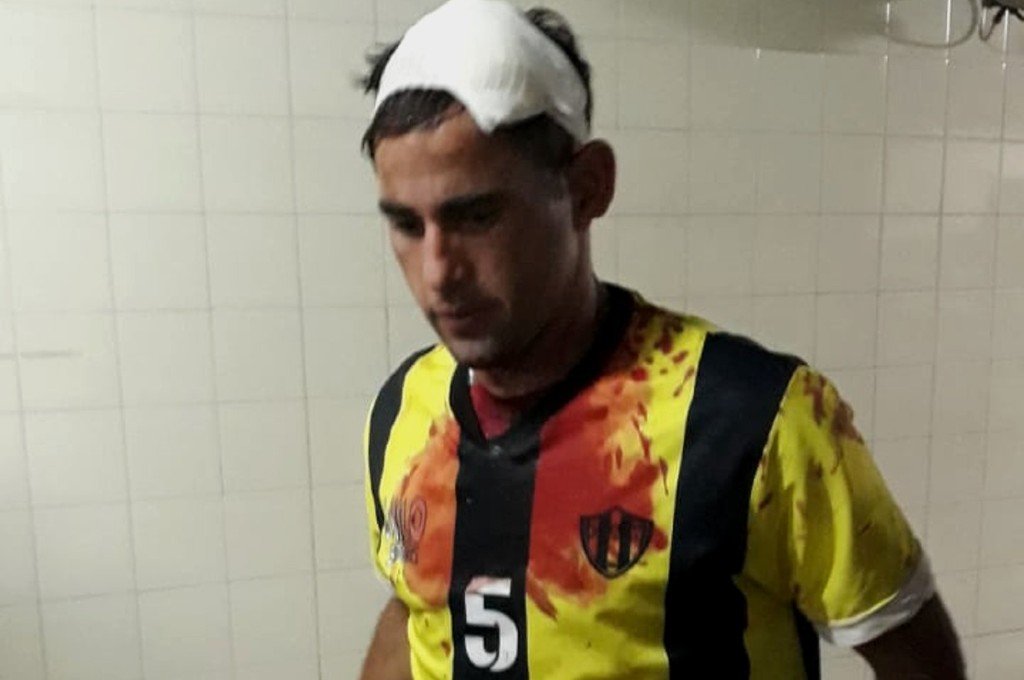Batista tuvo que ser trasladado a un centro asistencial.