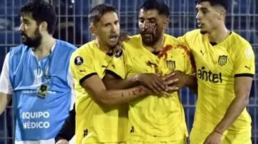 Las imágenes mostraron cómo quedó el jugador de Peñarol tras la agresión con un piedrazo que dio en su rostro. Captura de video