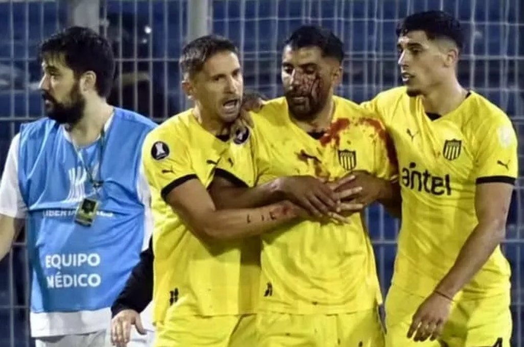 Las imágenes mostraron cómo quedó el jugador de Peñarol tras la agresión con un piedrazo que dio en su rostro. Captura de video