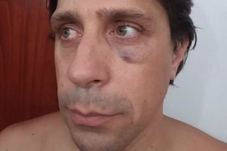 Rodoldo Stangoni. Gentileza