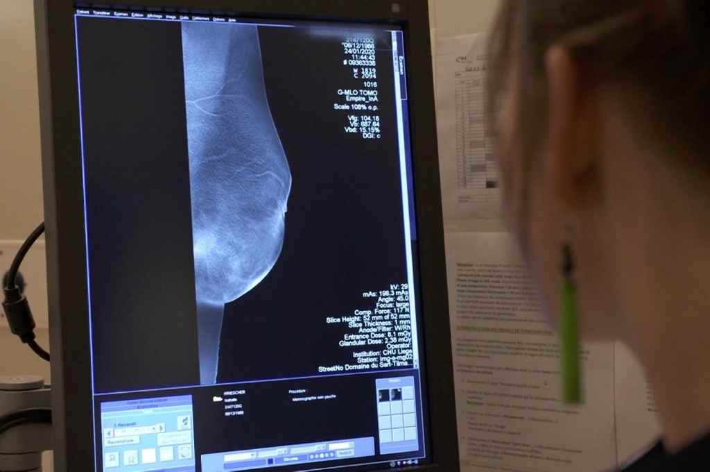 La mamografía