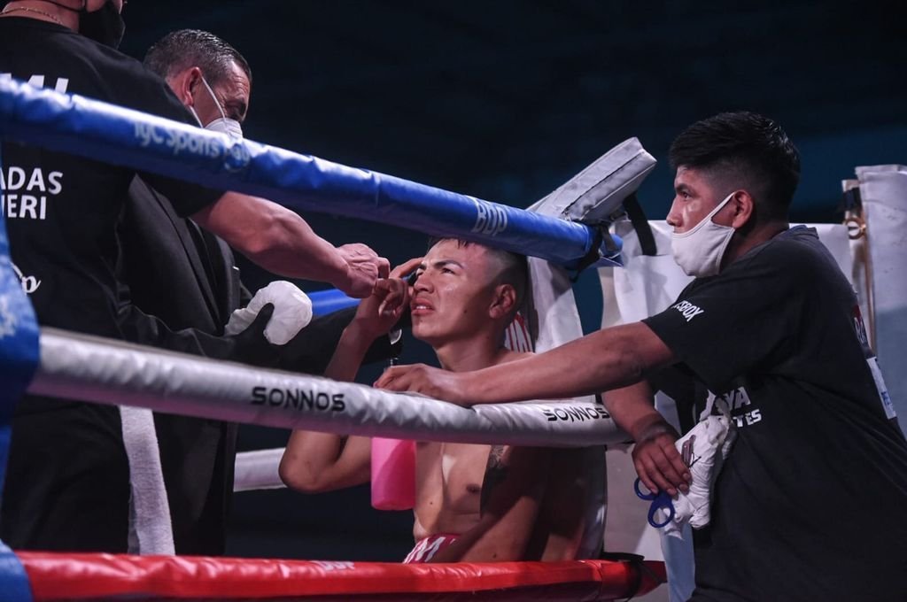 Los estudios médicos determinarán si Matías Lovera sufrió o no una lesión en su ojo. Gentileza Boxeo de Primera