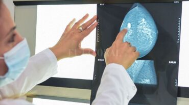 "El principal riesgo de tener cáncer de mama es ser mujer"