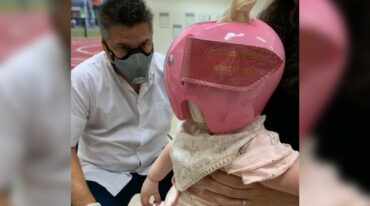 "Son cascos que ayudan a corregir deformidades craneales que se llaman plagiocefalia"