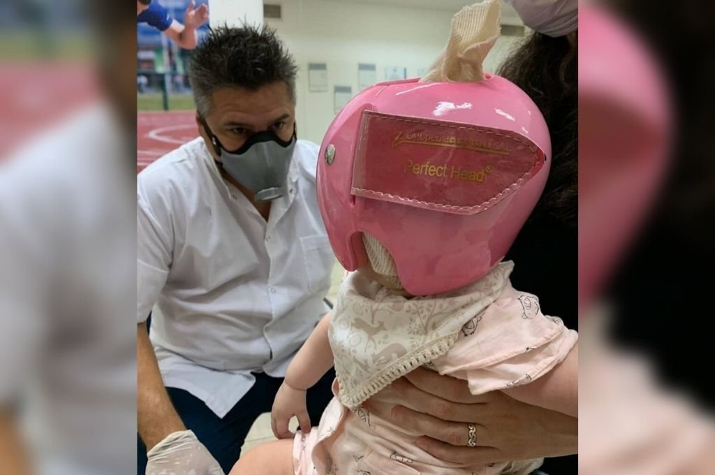 "Son cascos que ayudan a corregir deformidades craneales que se llaman plagiocefalia"