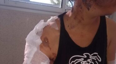 La víctima fue agredida de manera violenta. Archivo.