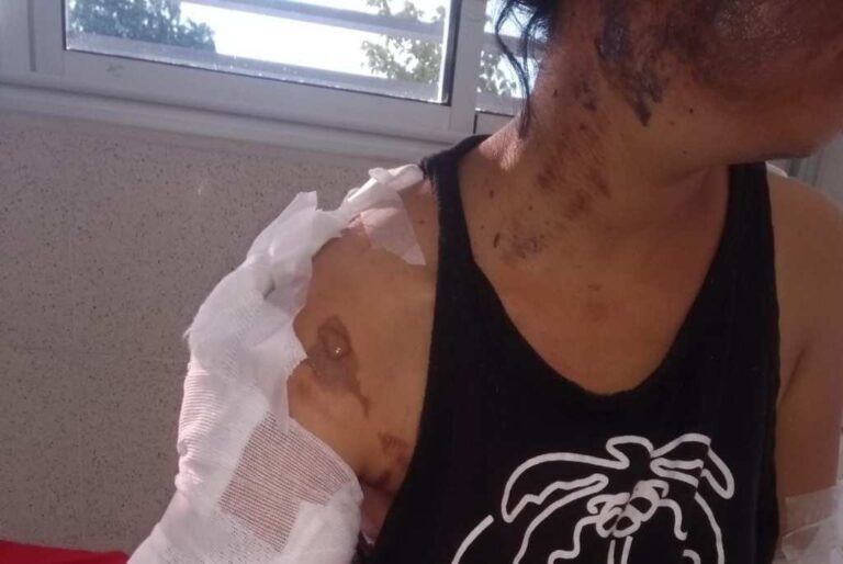 La víctima fue agredida de manera violenta. Archivo.