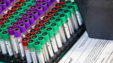 Gretel Naidich dijo que "este estudio es indispensable para verificar la compatibilidad de pacientes hipersensibilizados con el órgano a trasplantar". Gentileza: prensa Gobierno de Santa Fe.