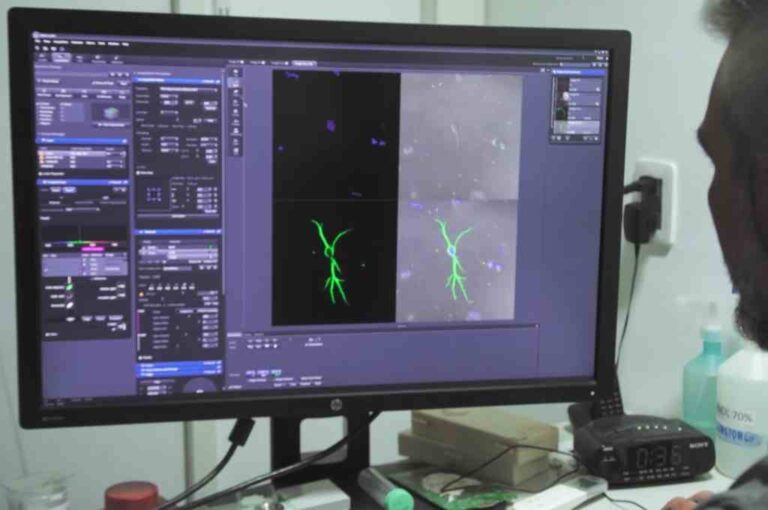 Para el director del Iprobyq