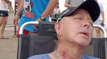 Ferrari recibió al menos 4 impactos de postas de goma.