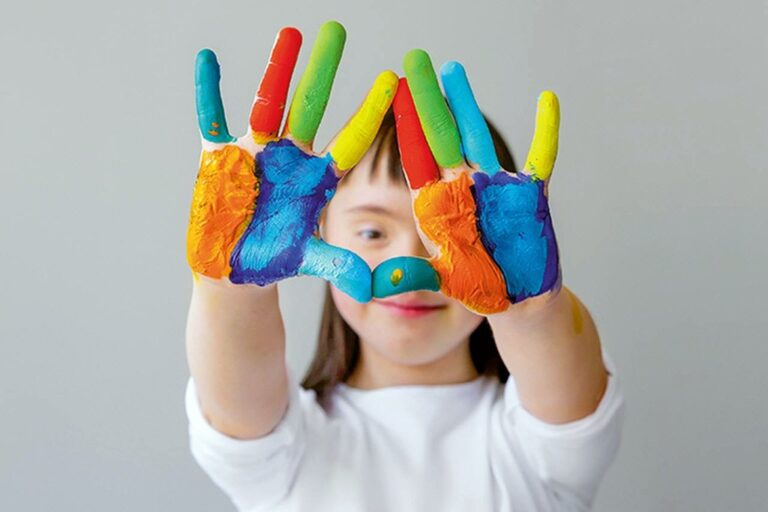 La celebración fue dispuesta con la finalidad de generar conciencia en la sociedad acerca de esta condición y enfatizar la inclusión social. Archivo