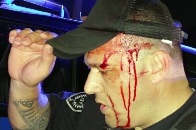 El oficial Walter Orrego fue alcanzado por un recortado de hierro arrojado con una gomera